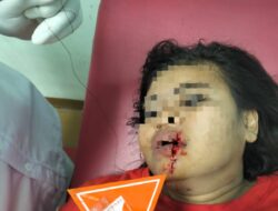 SPKT Polres Labuhanbatu Gerak Cepat Tanggapi Kasus Penganiayaan
